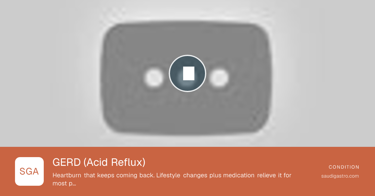 GERD (Acid Reflux)